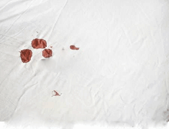 賓館床單血跡去除方法 血跡